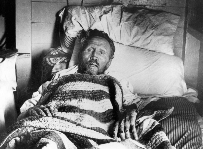 Sydney B. Swift [Public domain], <a href="https://commons.wikimedia.org/wiki/File:Father_Damien_on_his_deathbed.jpg"  target="_blank">via Wikimedia Commons</a>