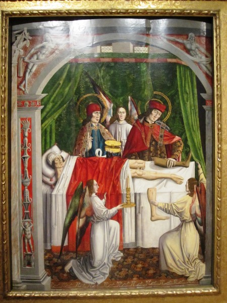 A Verger's Dream : Saints Cosmas and Damain perfoming a miraculous cure by transplantation of leg. Master of Los Balbases after Alonso de Sedano.

<a href="https://commons.wikimedia.org/wiki/File:A_Verger%27s_Dream.jpg" title="via Wikimedia Commons" target="_blank">Master of Los Balbases after Alonso de Sedano.</a> / Public domain